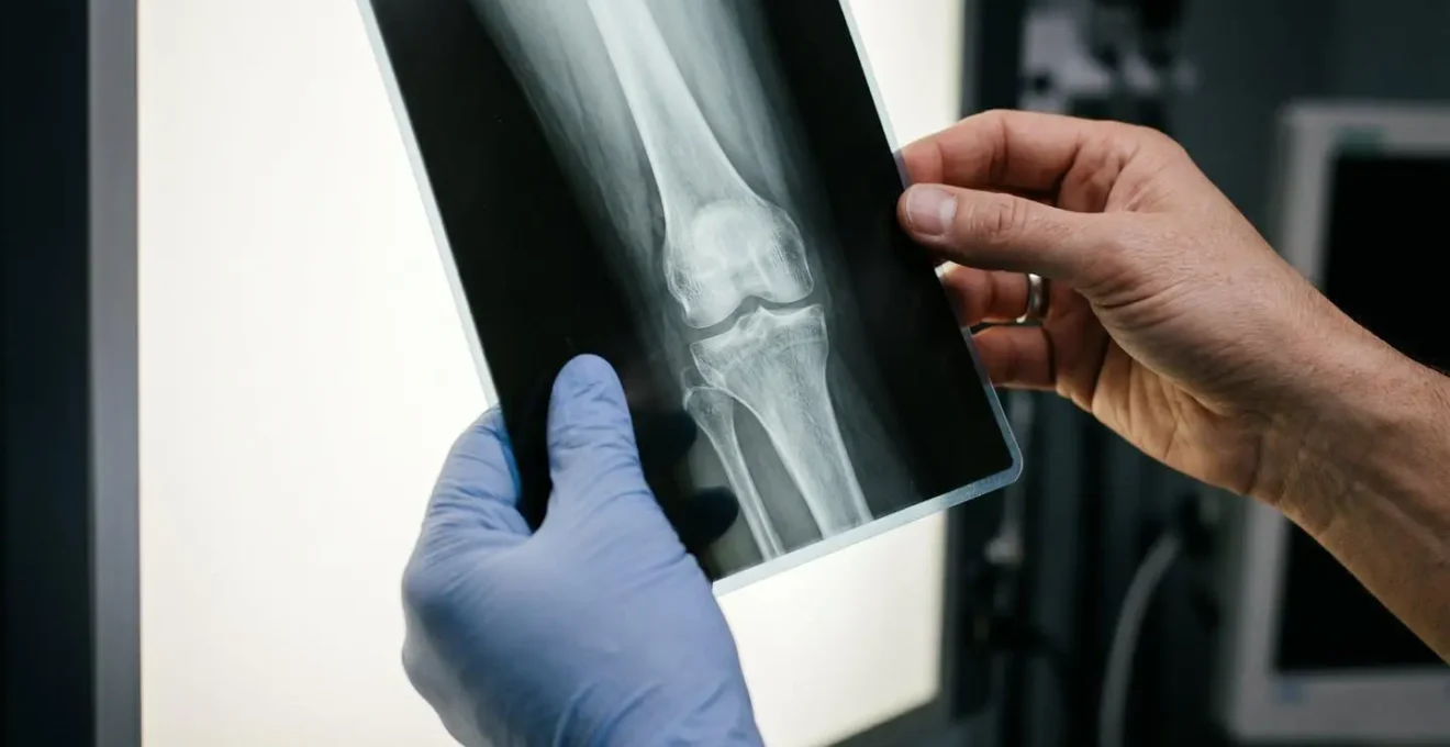 Expertise médicale pour l'évaluation des séquelles après un accident de scooter
